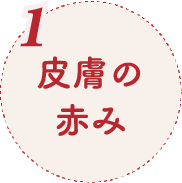 1.皮膚の赤み